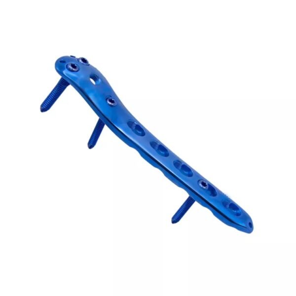 Placa de bloqueo femoral proximal-I
