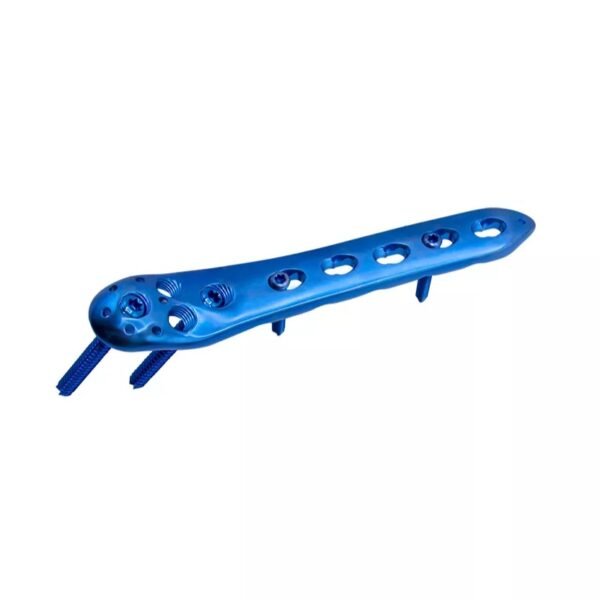 Placa de bloqueo femoral proximal II