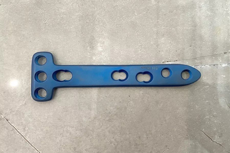 Placa de bloqueo para osteotomía tibial medial proximal real