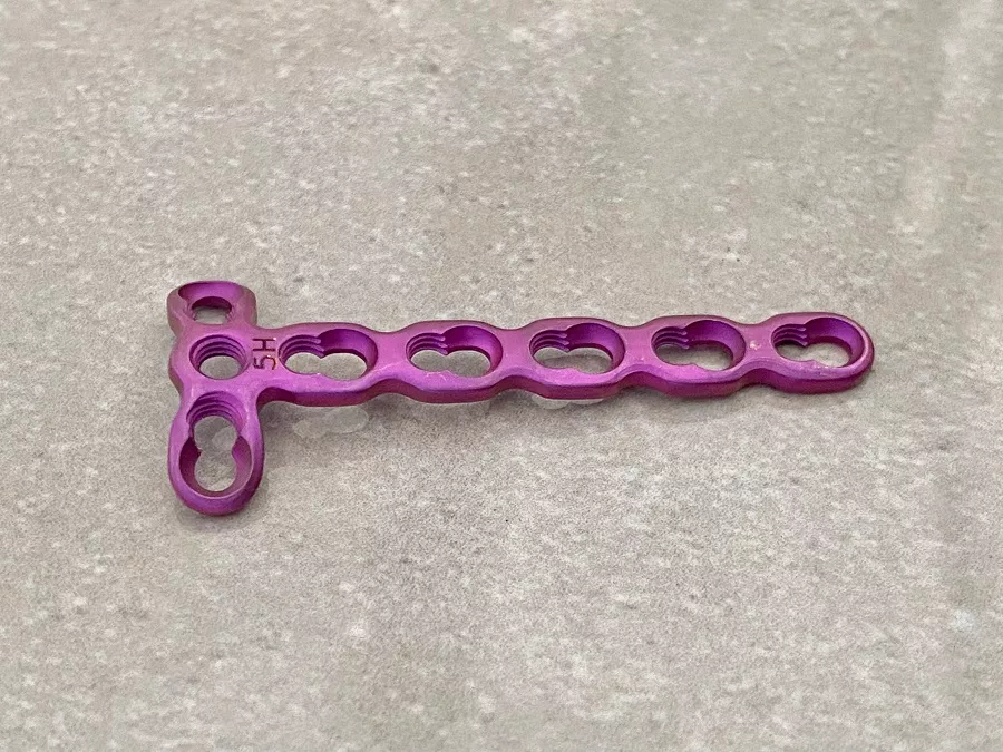 2.0 mm Mini T Locking Plate