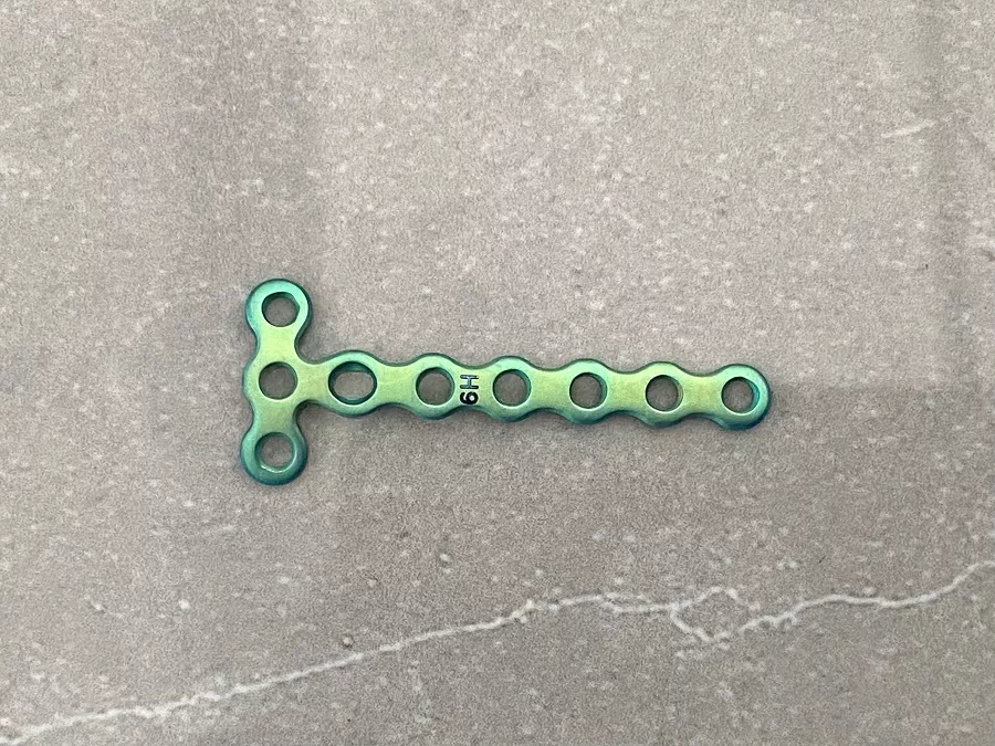 Placa de bloqueo Mini T de 1,5 mm (3 orificios)